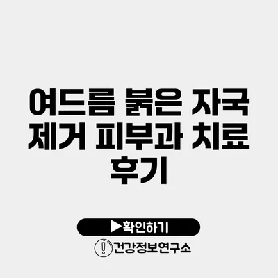 여드름 붉은 자국 제거 피부과 치료 후기